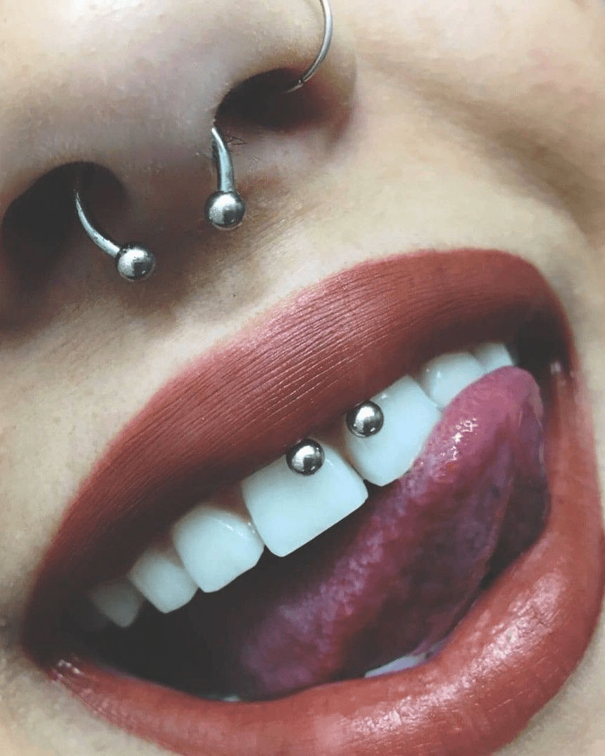 smiley piercing